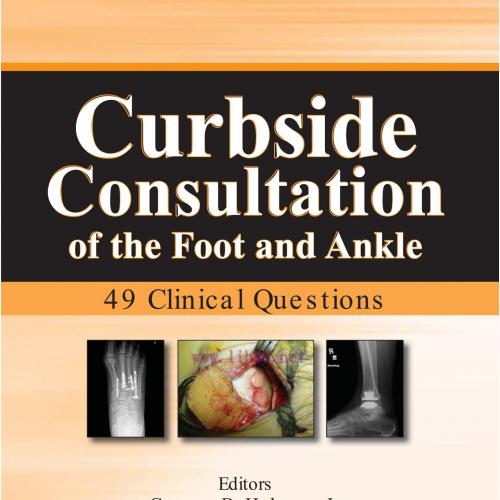 Curbside Consultation of the Foot and Ankle 49 Clinical Questions