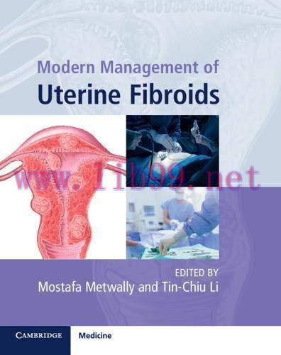 [PDF]Modern Management of Uterine Fibroids