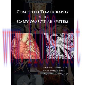 [M]心血管系统的CT扫描(Computed Tomography of the Cardiovascular System)