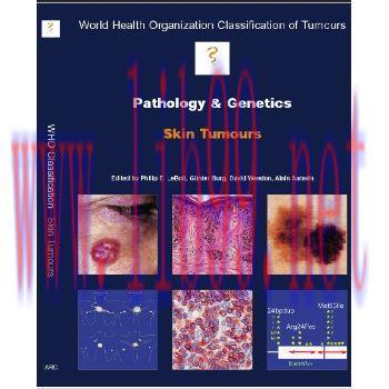 [M]世界卫生组织肿瘤分类 - 皮肤肿瘤的病理学和遗传学(World Health Organization Classification of Tumours--Pathology and Genetics of Skin Tumours）