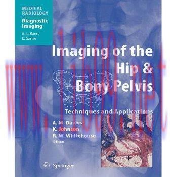 [M]Imaging of the Hip & Bony Pelvis Techniques and Applications