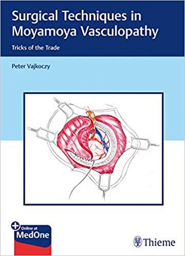 [PDF]Surgical Techniques in Moyamoya Vasculopathy: Tricks of the Trade